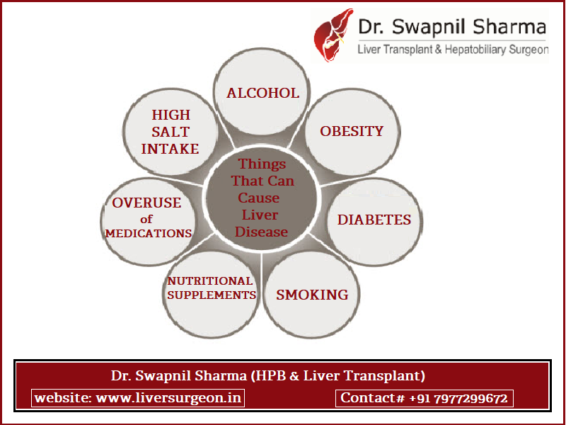 Things that can cause liver disease