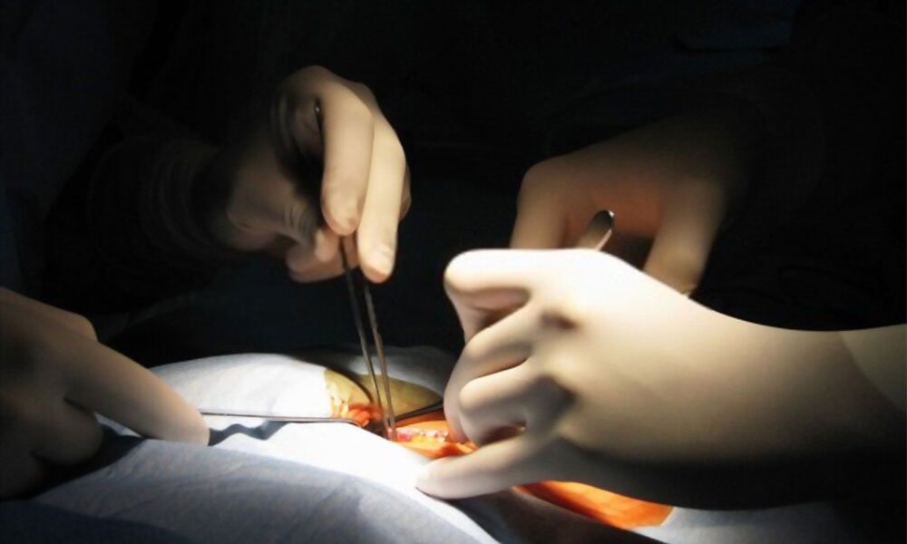Liver Transplant In Nashik