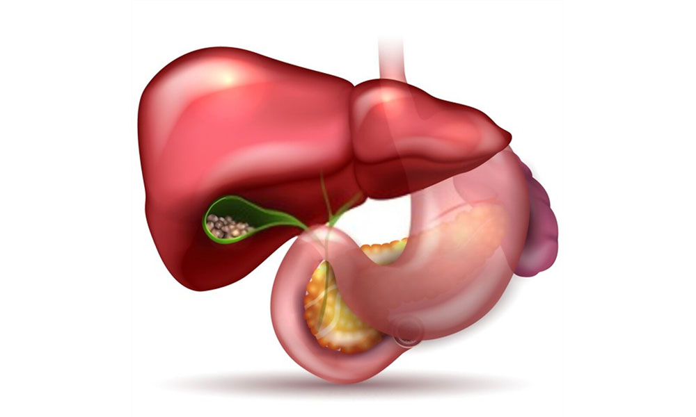 Gallbladder Treatment In Pune